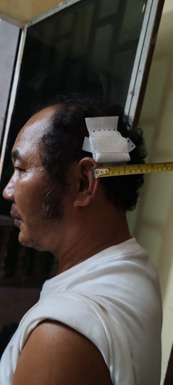 a drug kill po1
