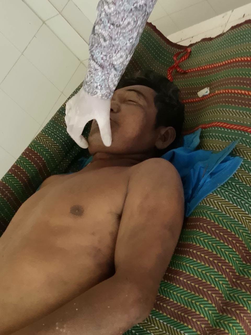 a die in police